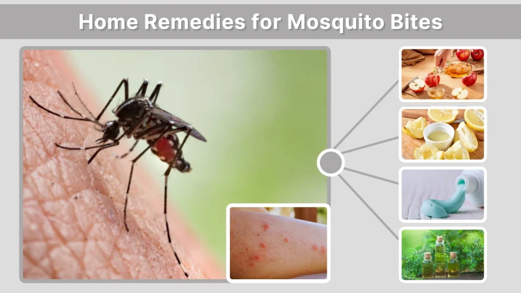 Home Remedies for Mosquito Bites