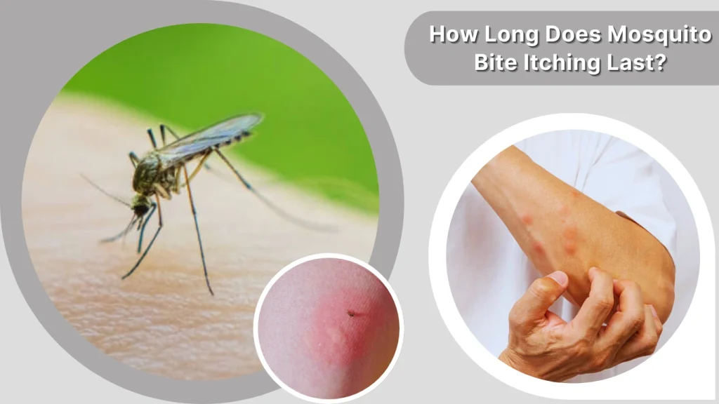 How Long Does Mosquito Bite Itching Last