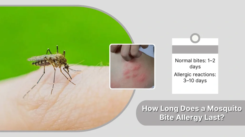 How Long Does a Mosquito Bite Allergy Last