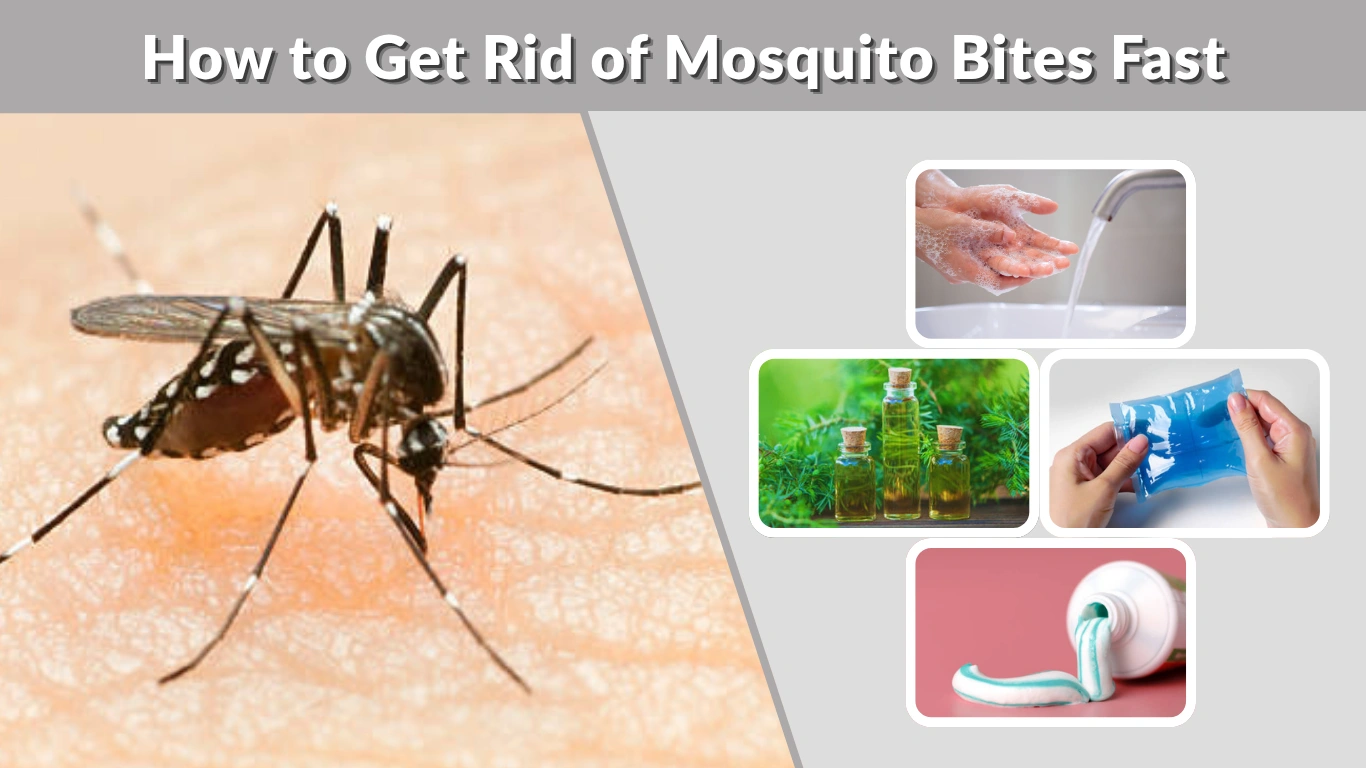 How to Get Rid of Mosquito Bites Fast (Instant Relief That Works)