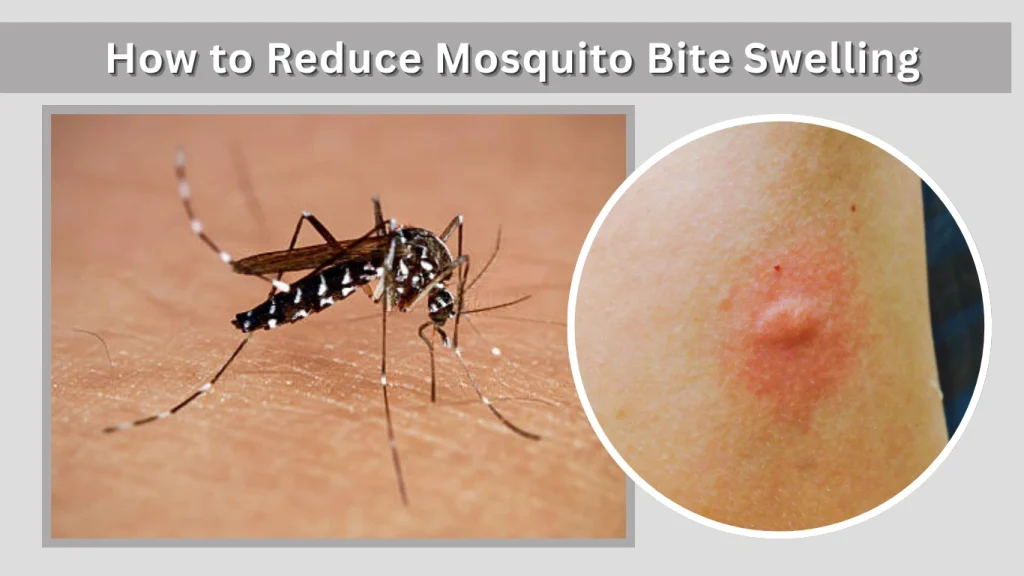 How to Reduce Mosquito Bite Swelling