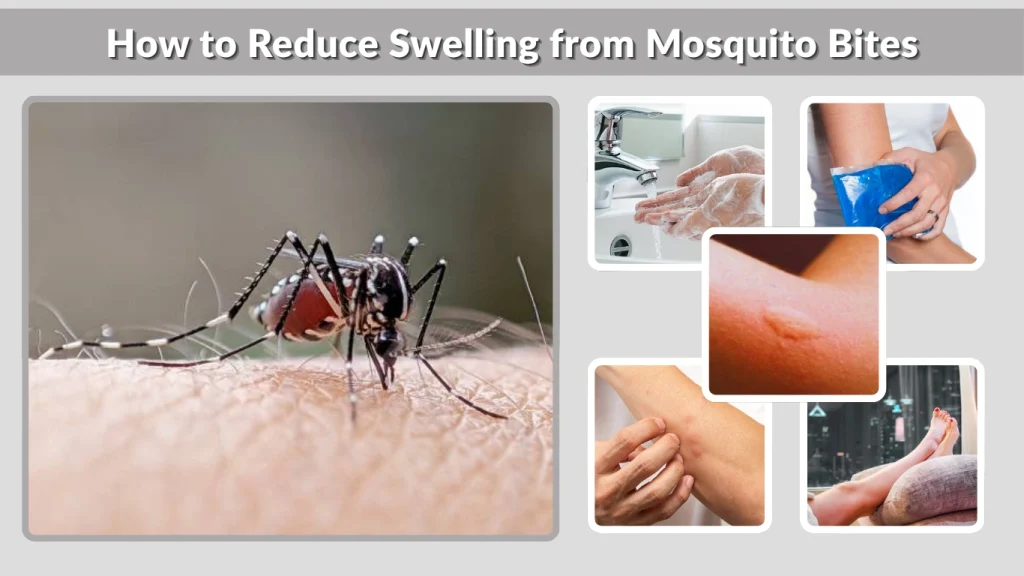 How to Reduce Swelling from Mosquito Bites