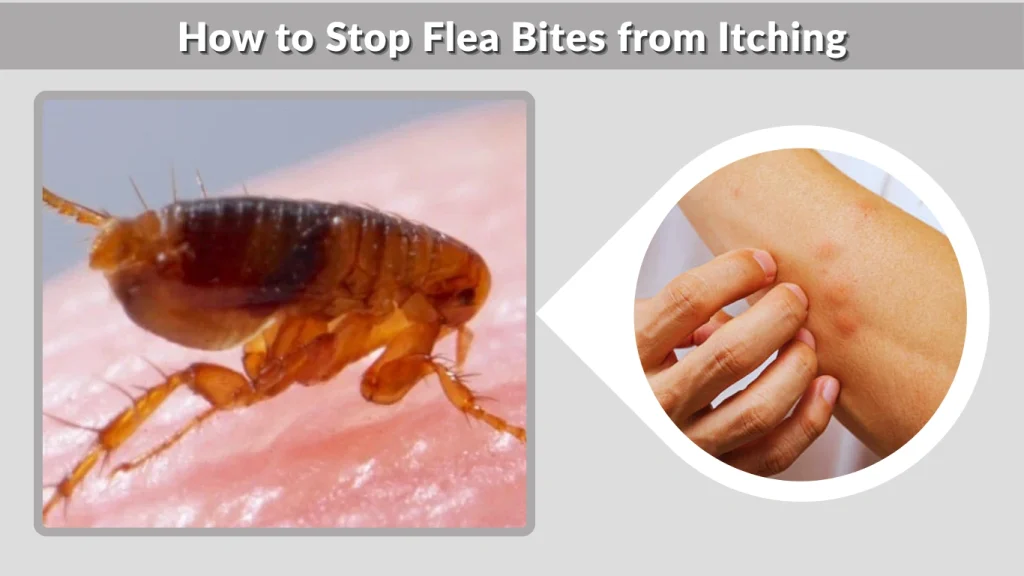 How to Stop Flea Bites from Itching