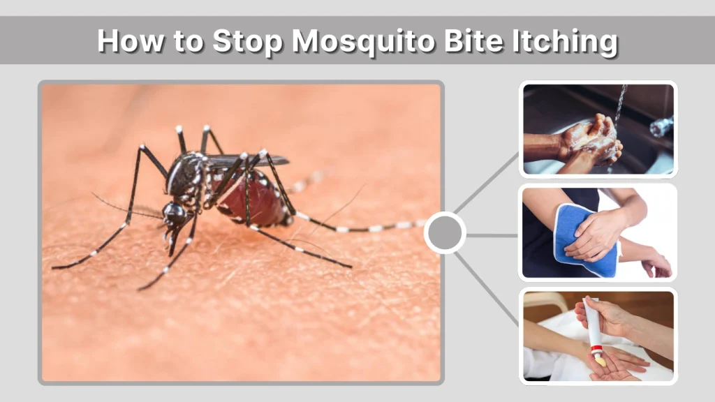How to Stop Mosquito Bite Itching