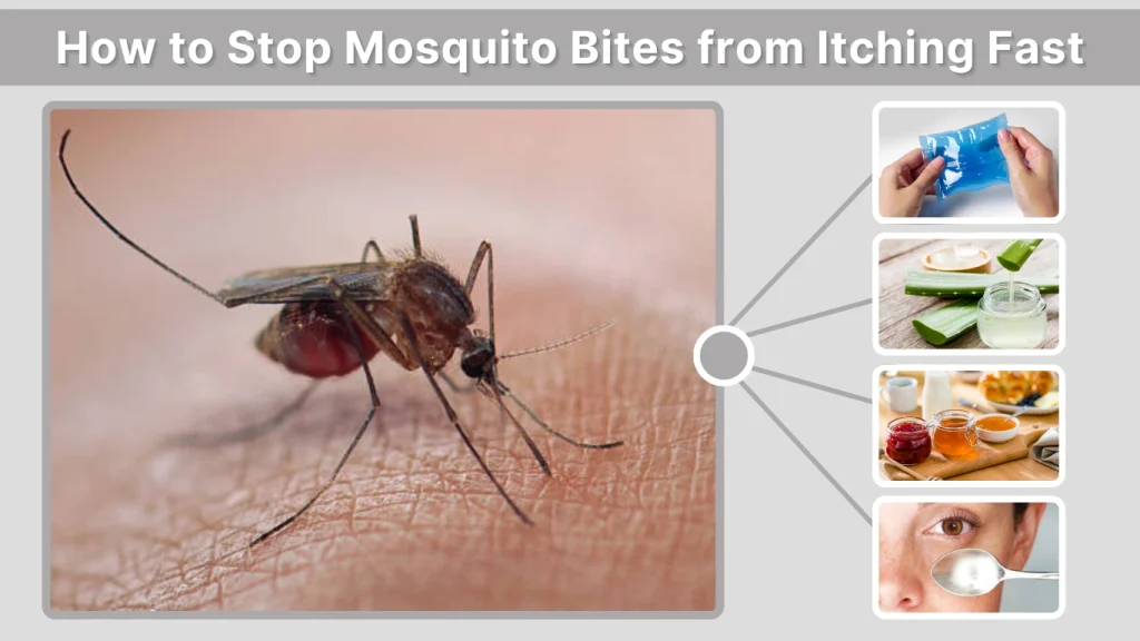 How to Stop Mosquito Bites from Itching Fast