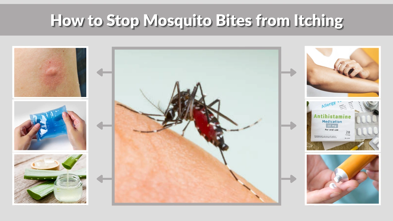 How to Stop Mosquito Bites from Itching Remedies & Treatments