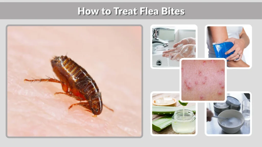 How to Treat Flea Bites