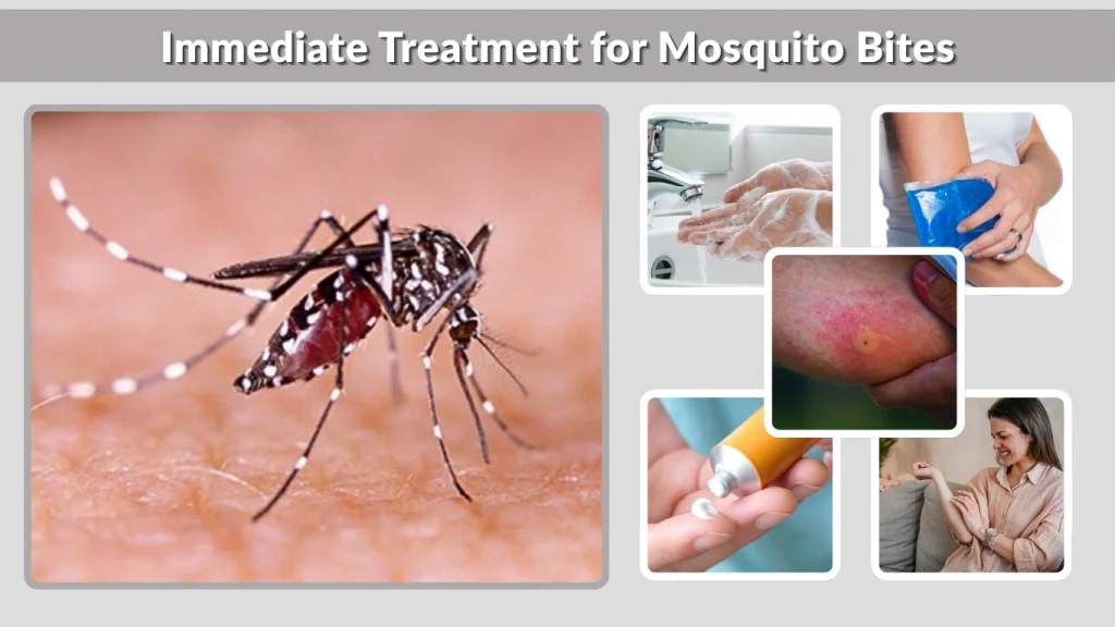Immediate Treatment for Mosquito Bites