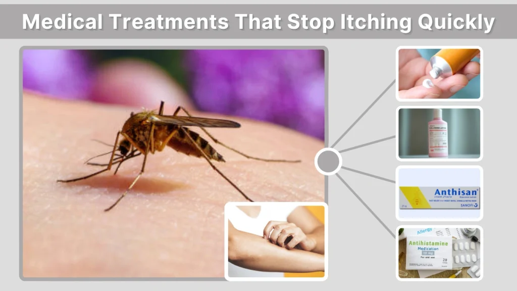 Medical Treatments That Stop Itching Quickly