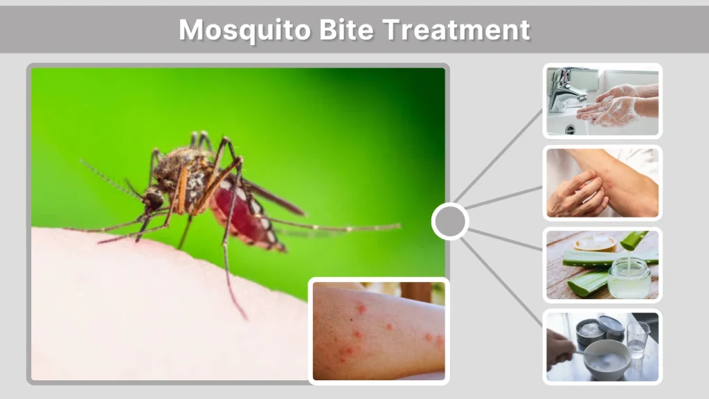 Mosquito Bite Treatment