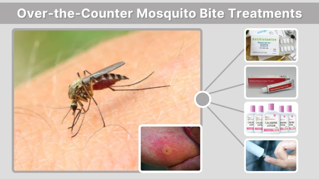 Over-the-Counter Mosquito Bite Treatments