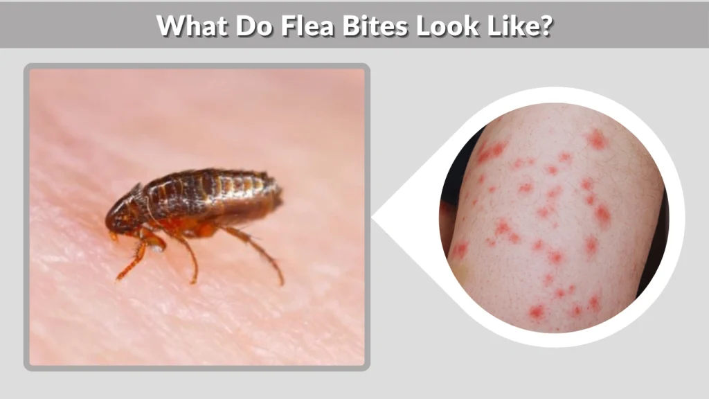 What Do Flea Bites Look Like