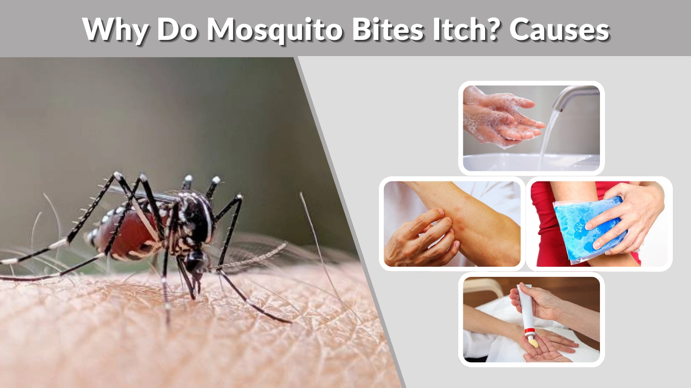 Why Do Mosquito Bites Itch Causes, Science, and Relief