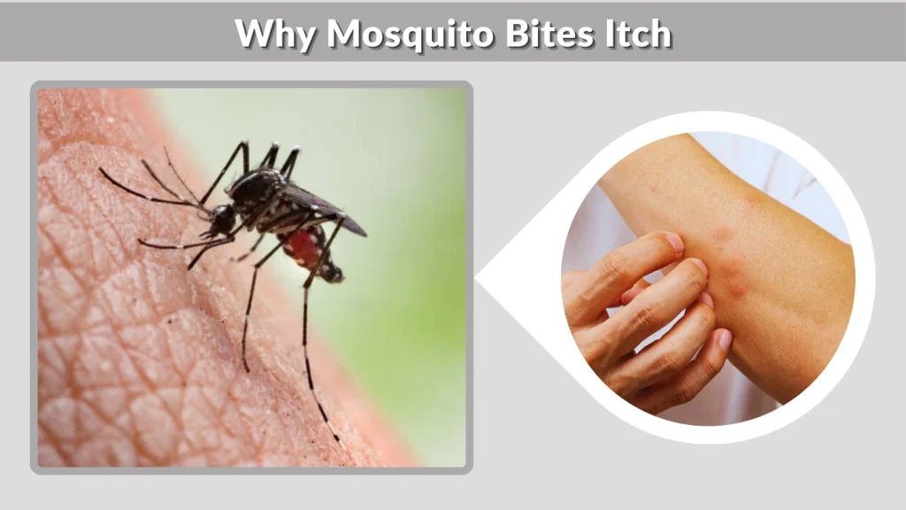 Why Mosquito Bites Itch