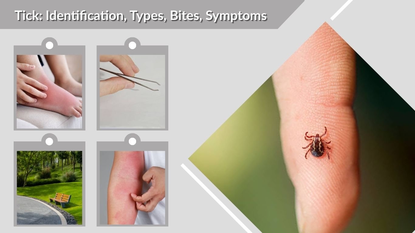 Tick: Identification, Types, Bites, Symptoms & Prevention