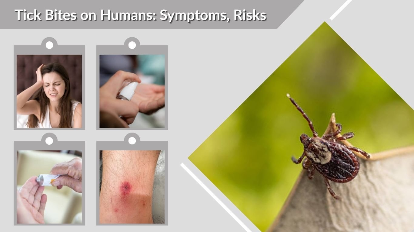 Tick Bites on Humans: Symptoms, Risks, and Treatment