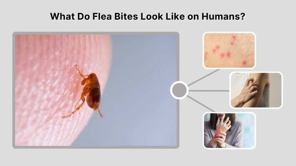 What Do Flea Bites Look Like on Humans?