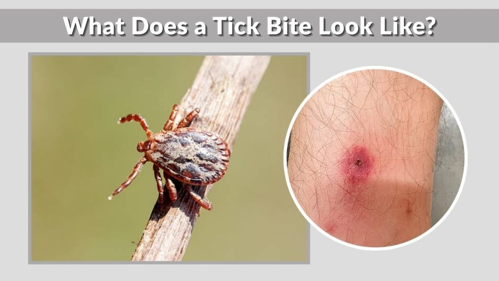 What Does a Tick Bite Look Like?