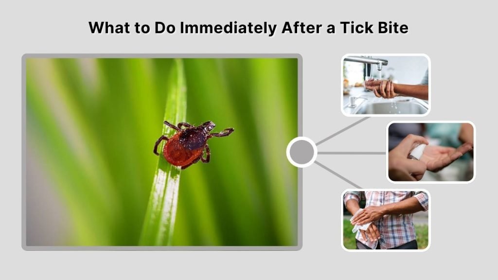 What to Do Immediately After a Tick Bite