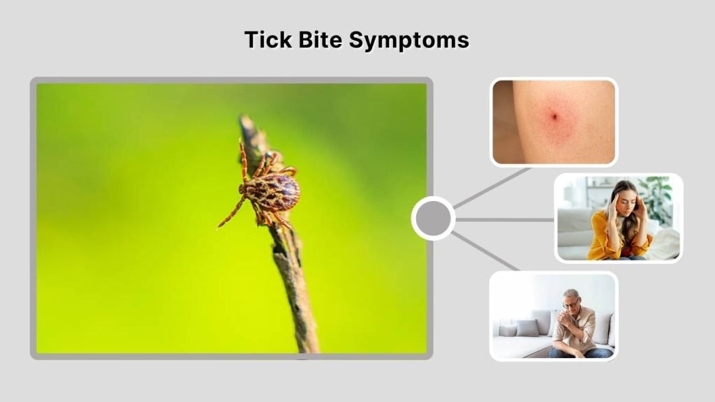 Tick Bite Symptoms