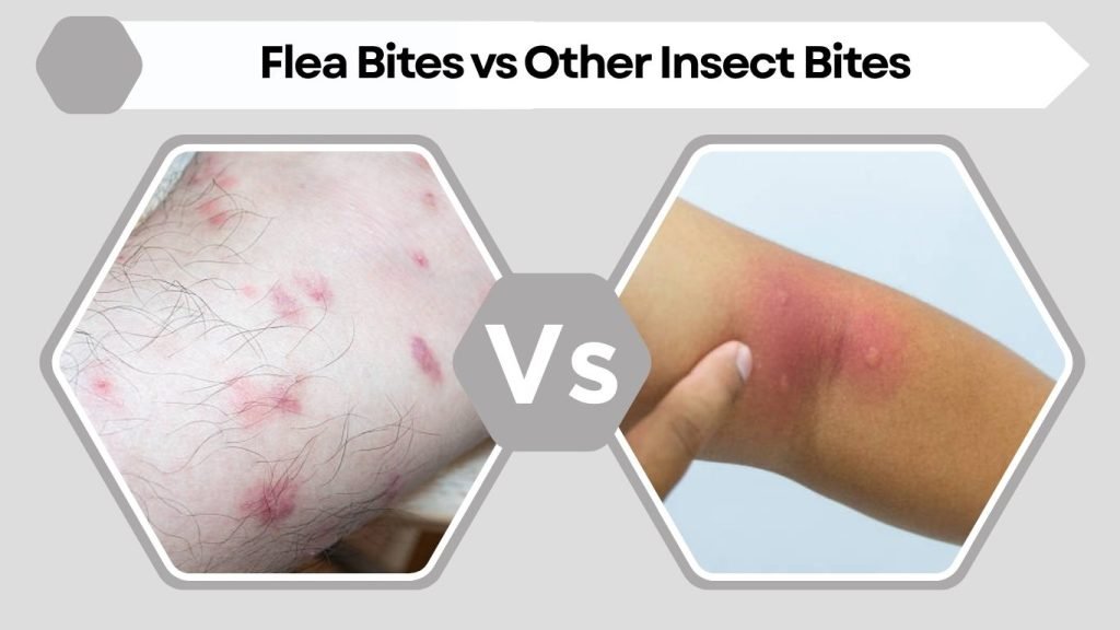Flea Bites vs Other Insect Bites