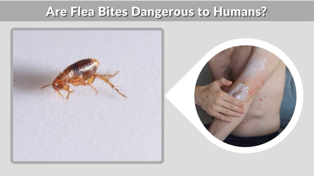 Are Flea Bites Dangerous to Humans?