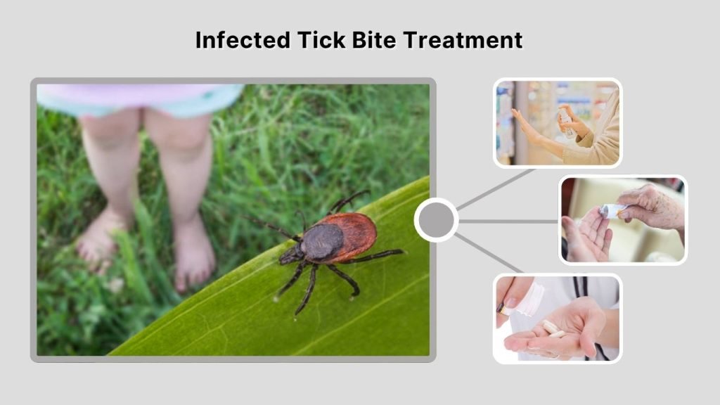 Infected Tick Bite Treatment