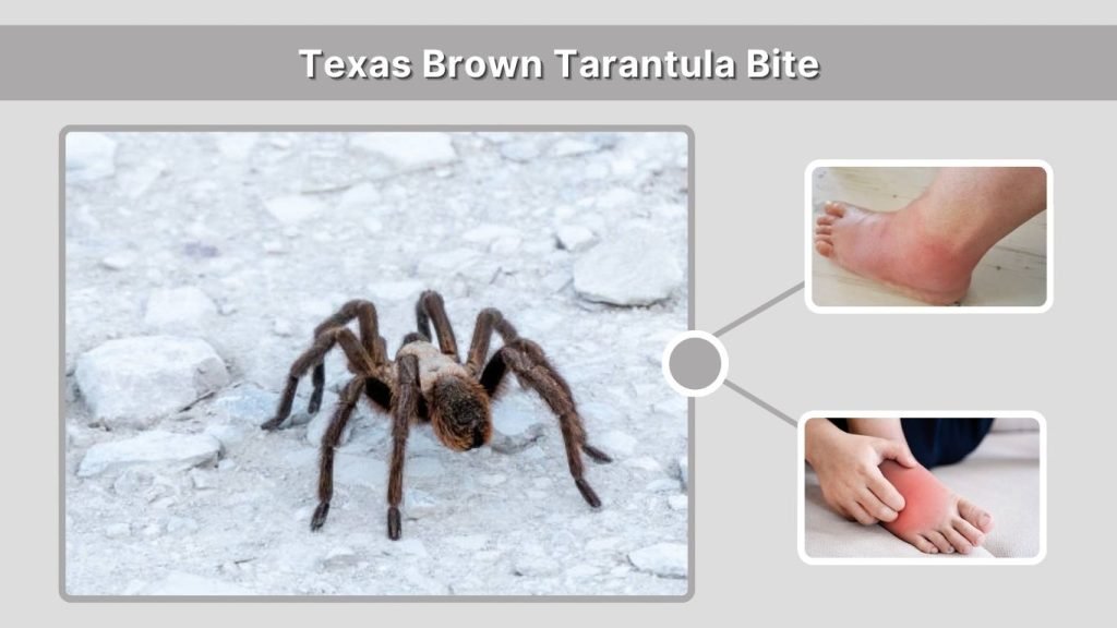 Texas Brown Tarantula Bite