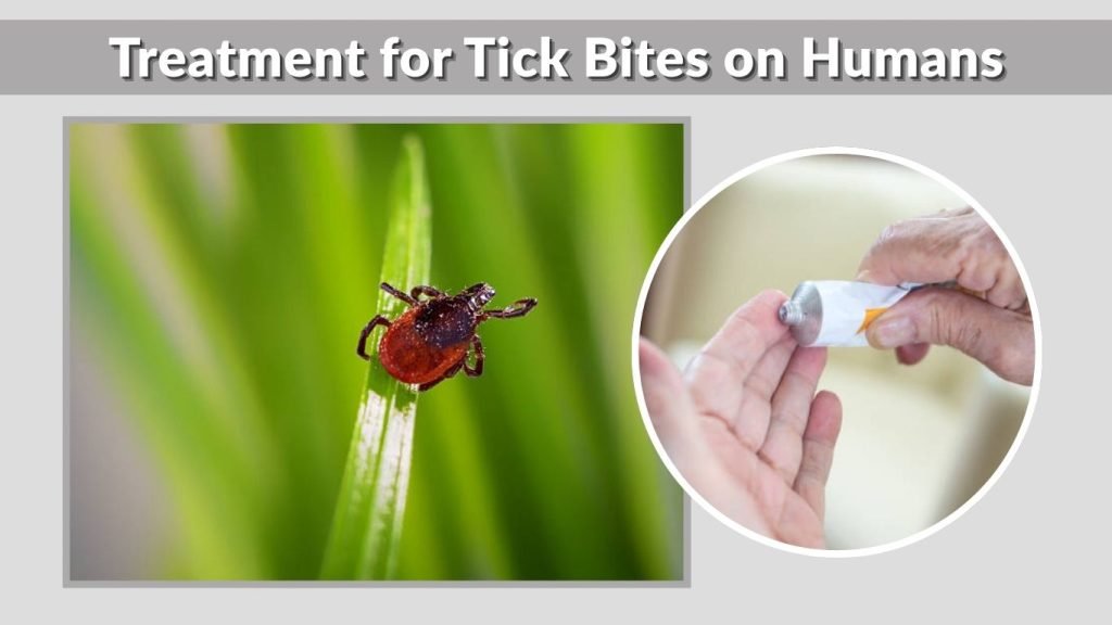 Treatment for Tick Bites on Humans