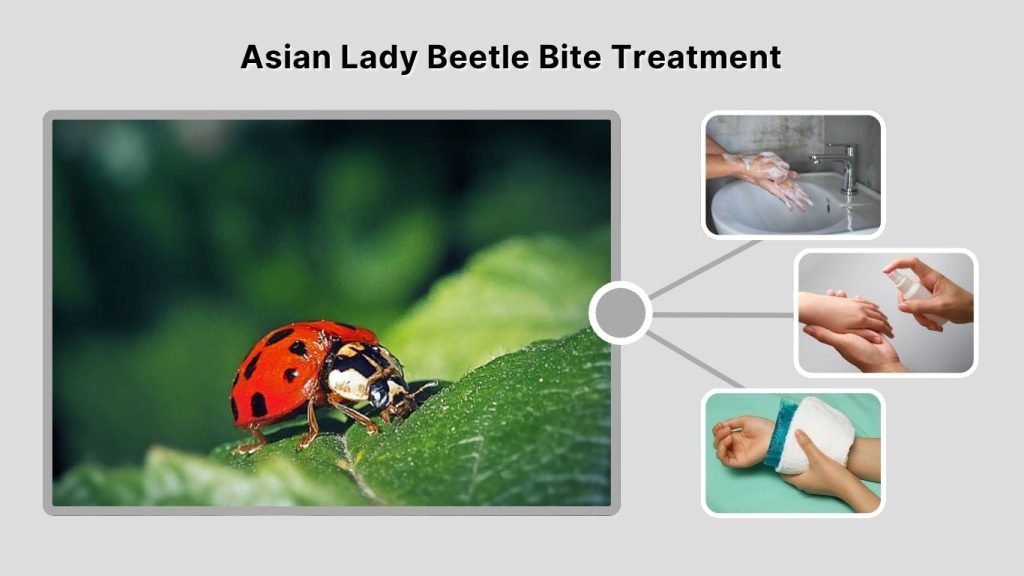 Asian Lady Beetle Bite Treatment