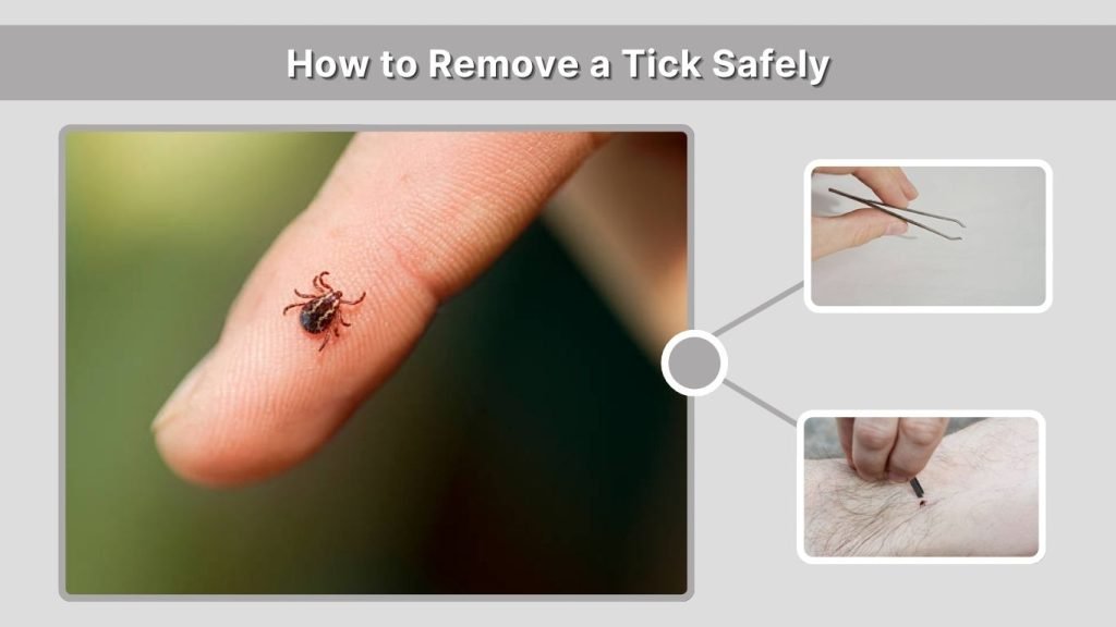 How to Remove a Tick Safely