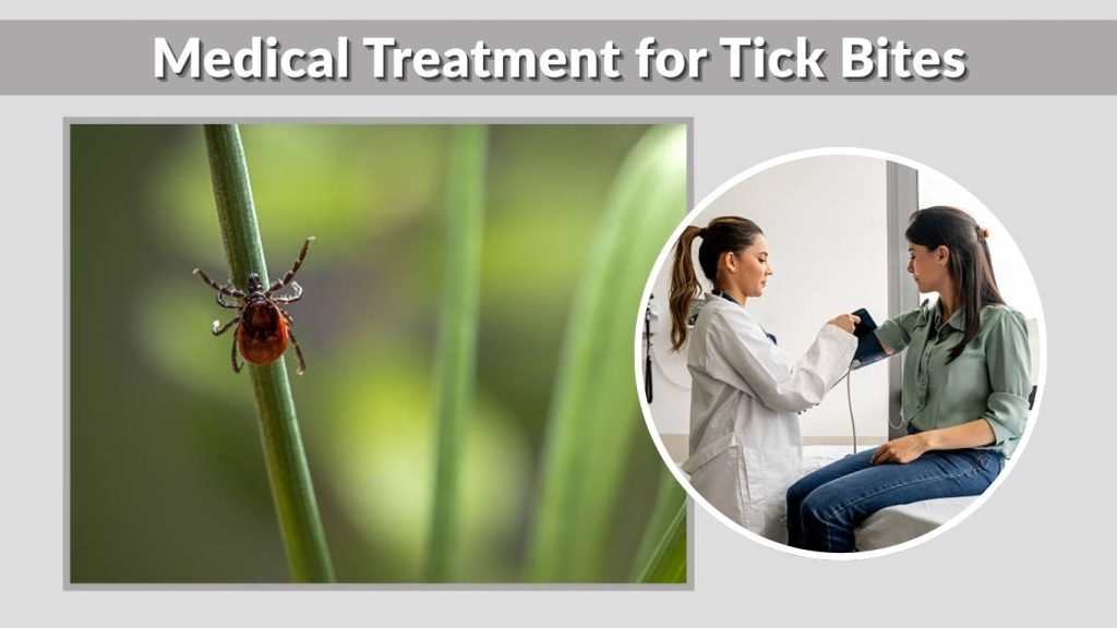 Medical Treatment for Tick Bites