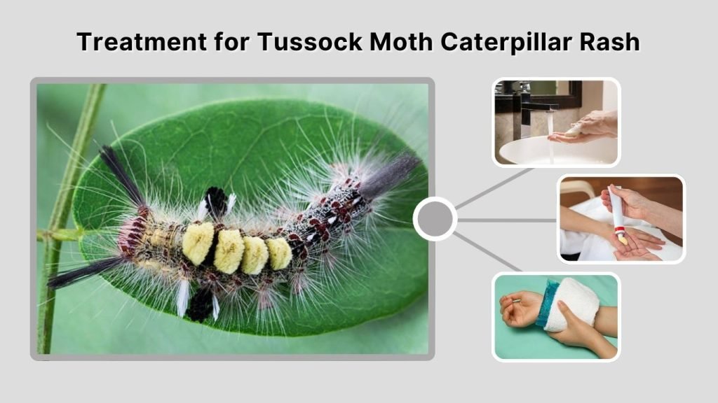 Treatment for Tussock Moth Caterpillar Rash