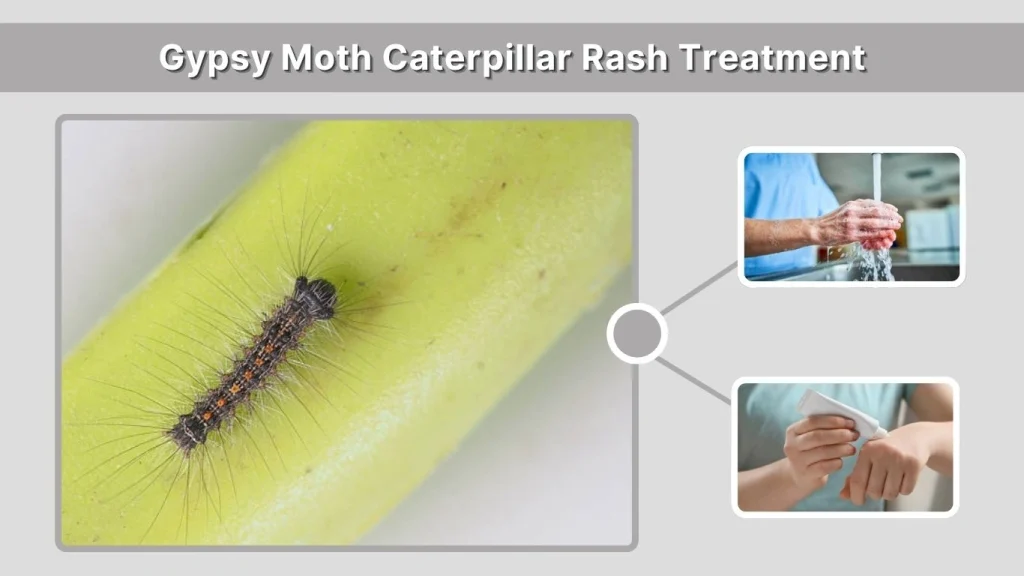 Gypsy Moth Caterpillar Rash Treatment