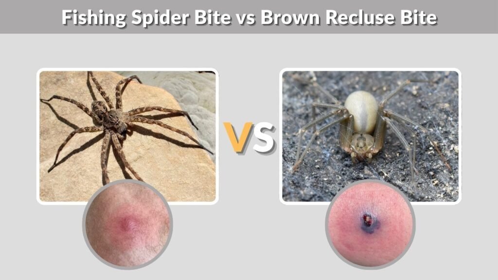 Fishing Spider Bite vs Brown Recluse Bite