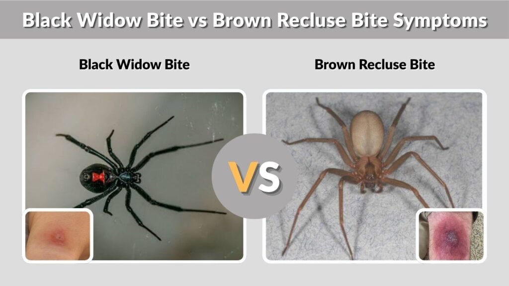 Black Widow Bite vs Brown Recluse Bite Symptoms