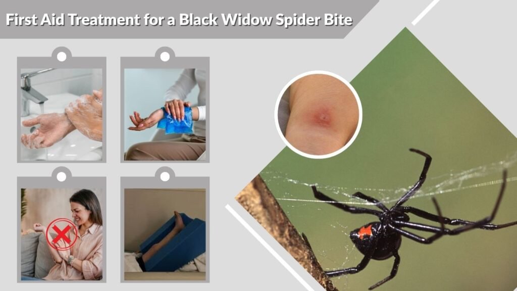 First Aid Treatment for a Black Widow Spider Bite