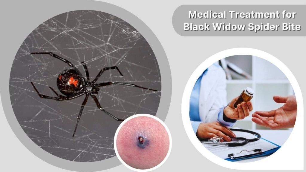 Medical Treatment for Black Widow Spider Bite