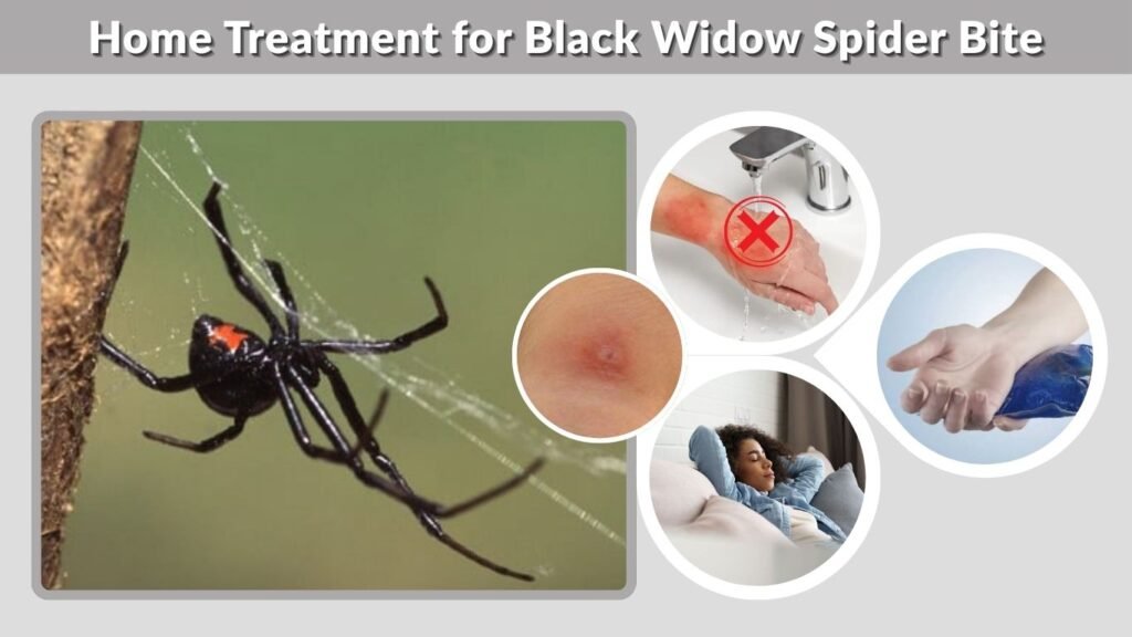 Home Treatment for Black Widow Spider Bite