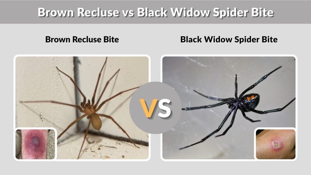 Brown Recluse vs Black Widow Spider Bite