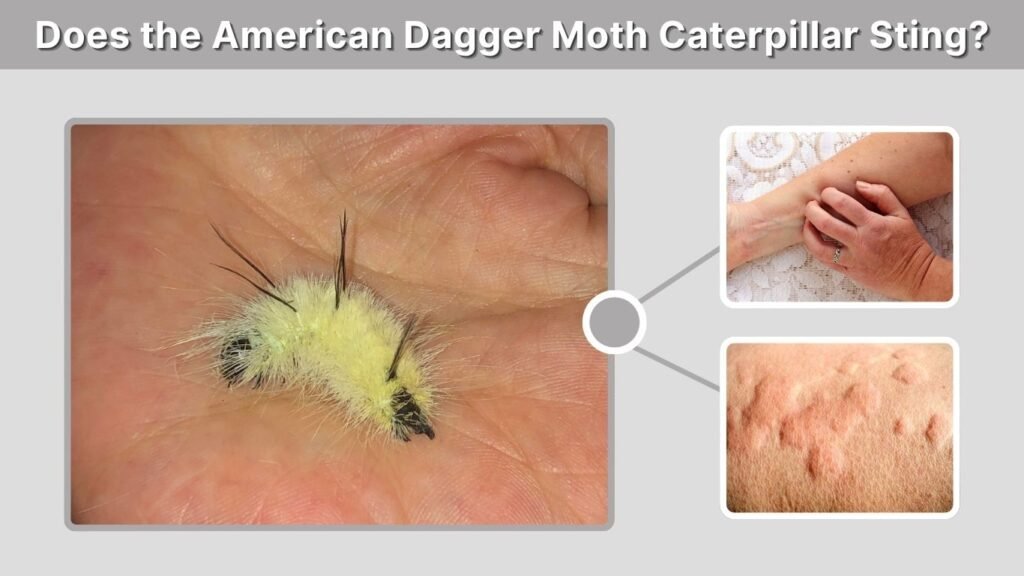 Does the American Dagger Moth Caterpillar Sting?