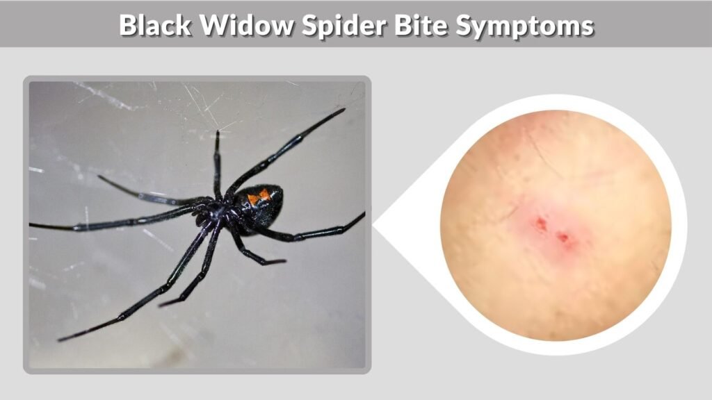 Black Widow Spider Bite Symptoms
