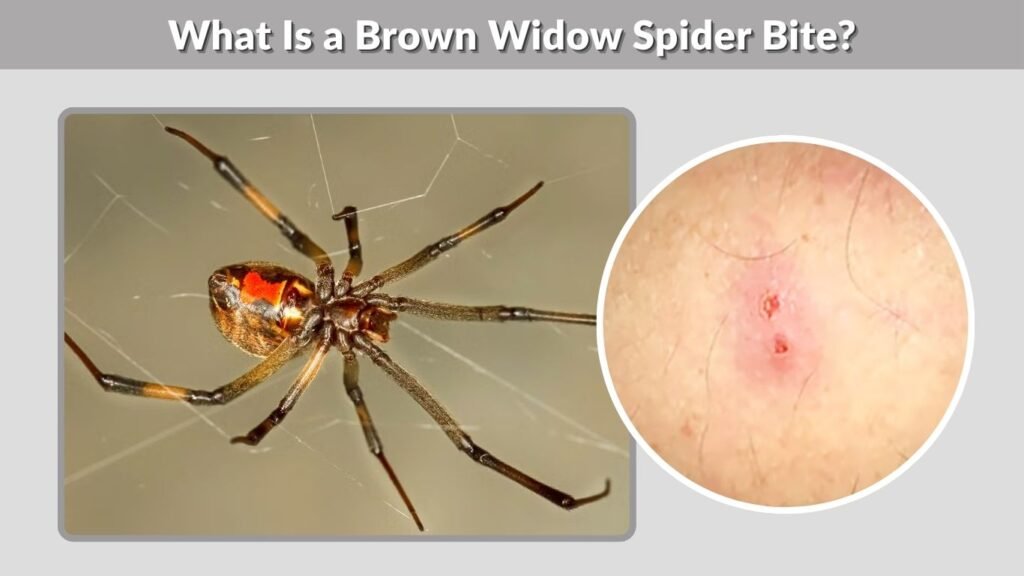 What Is a Brown Widow Spider Bite?