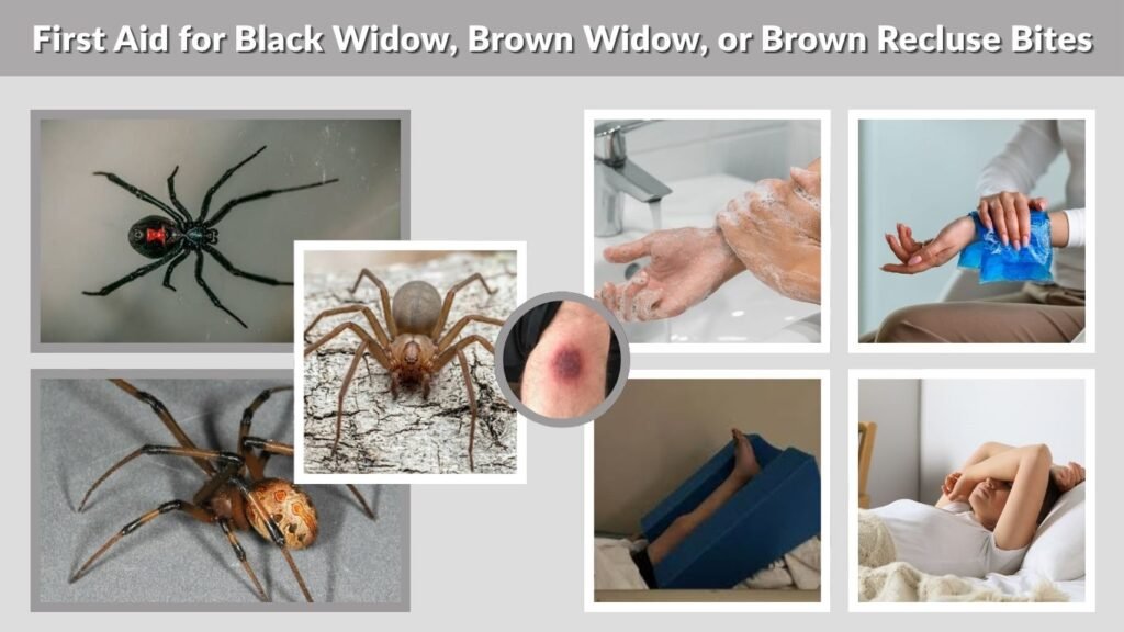 First Aid for Black Widow, Brown Widow, or Brown Recluse Bites