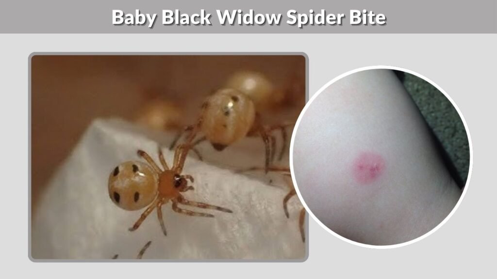 Baby Black Widow Spider Bite