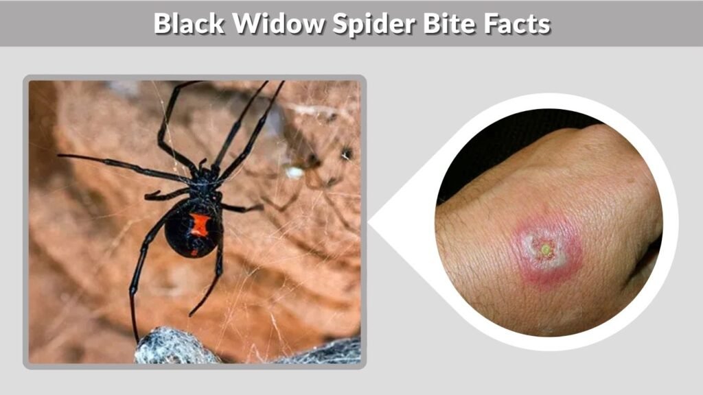 Black Widow Spider Bite Facts