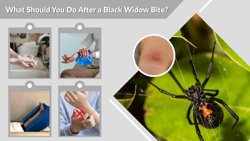 What Should You Do After a Black Widow Bite?