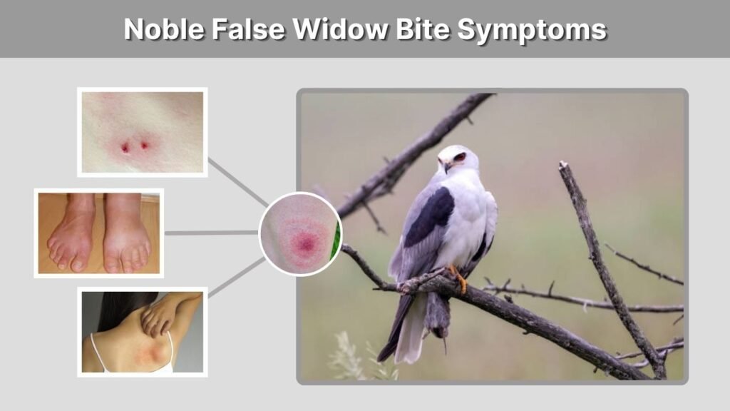 Noble False Widow Bite Symptoms