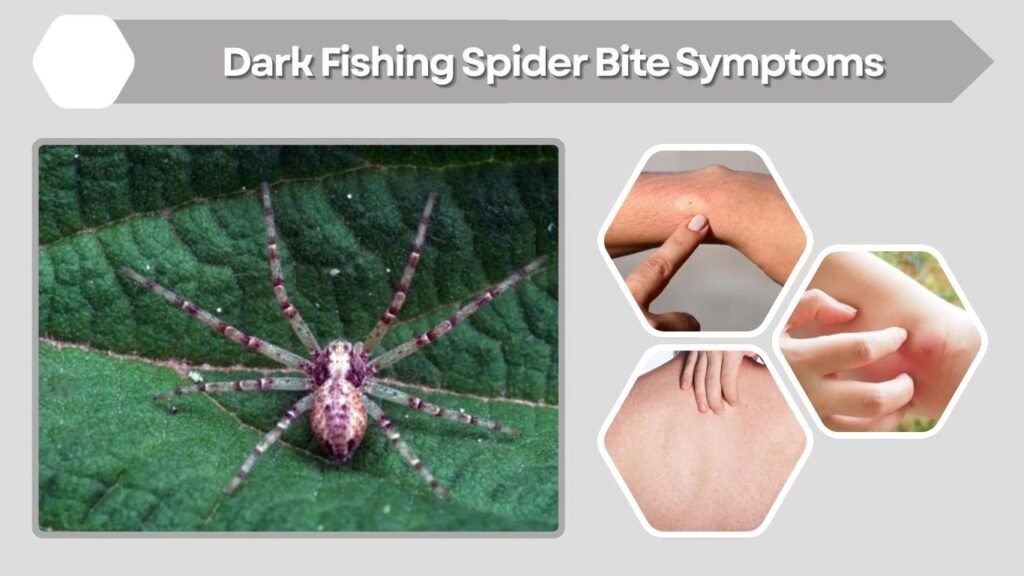 Dark Fishing Spider Bite Symptoms