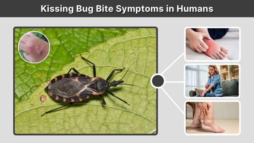 Kissing Bug Bite Symptoms in Humans